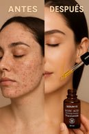 Compre 1 y Llévate 2 - Sérum 10 Ácido Kojic + Niacinamida + REGALO: Contorno de Ojos con Colágeno