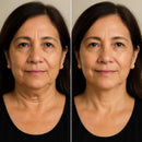 Tonificador de Rostro SkinLift | Elimina papada y flacidez en minutos