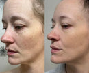 Tonificador y Reductor Facial 3 en 1 + Obsequio Exclusivo